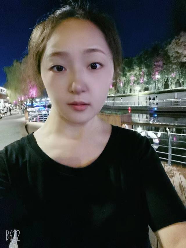 张阿姨缩略图2