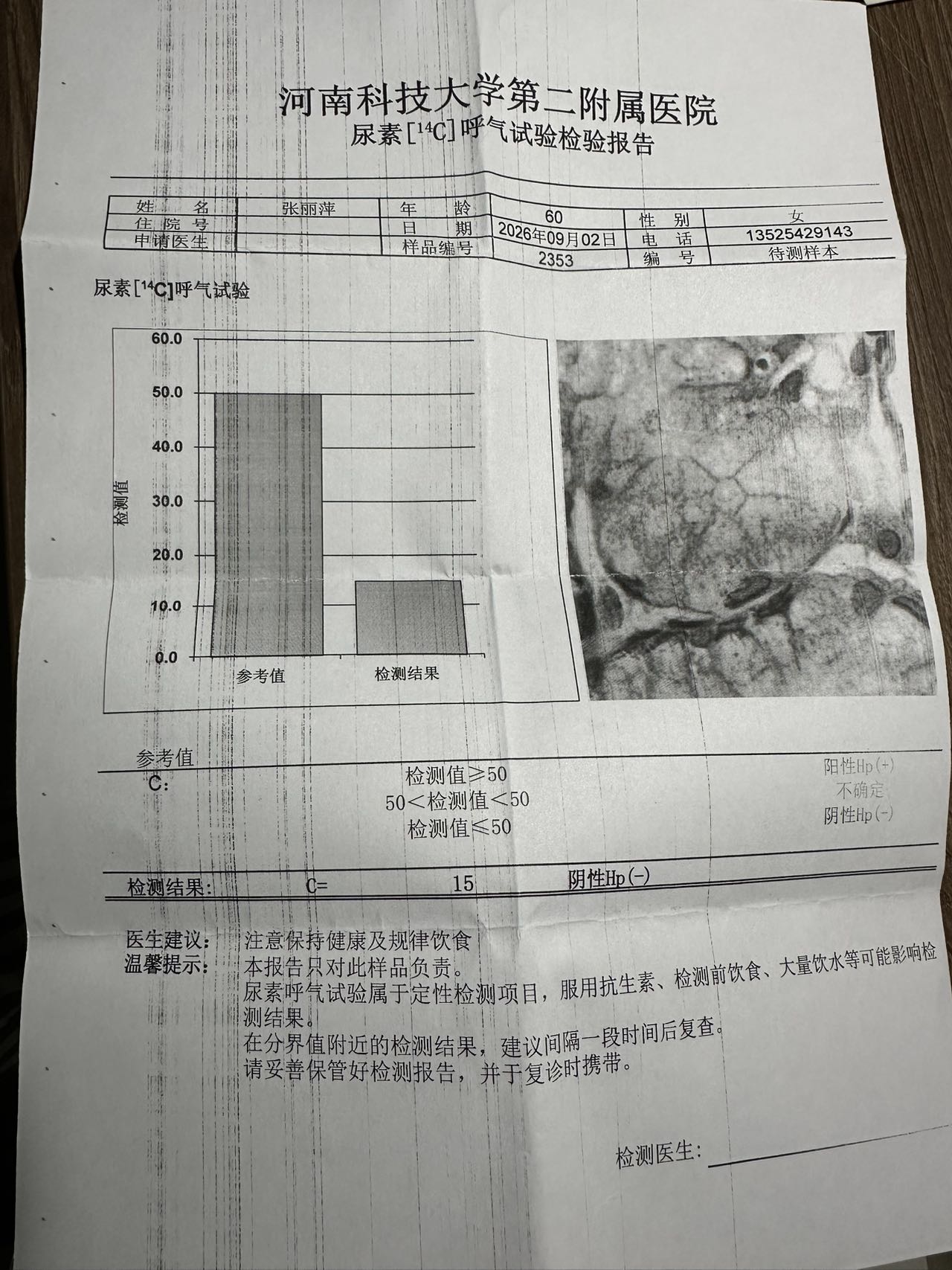 张阿姨职业证书5