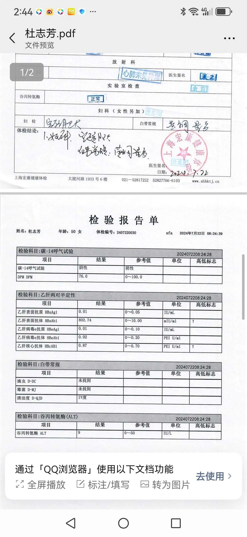 杜阿姨工作生活照11