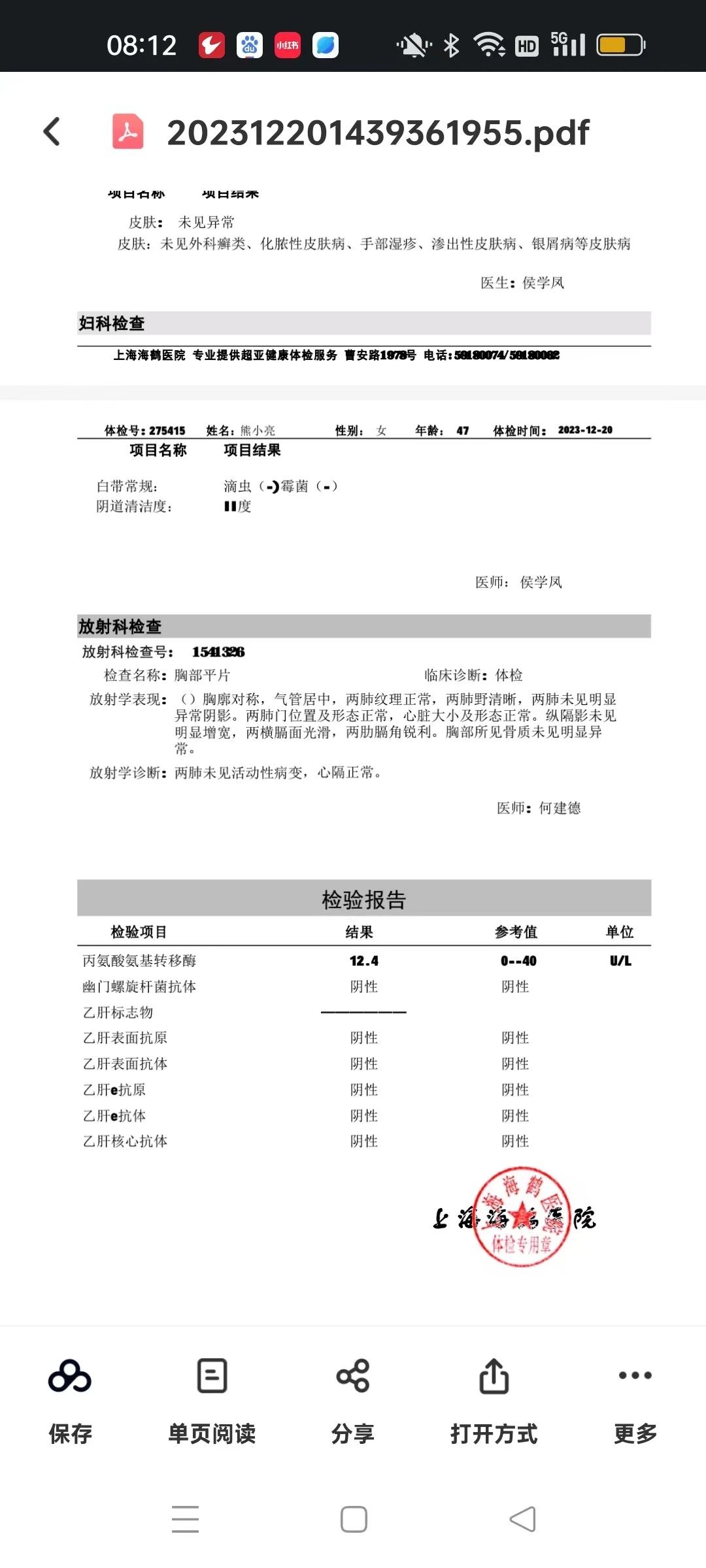 熊阿姨工作生活照10