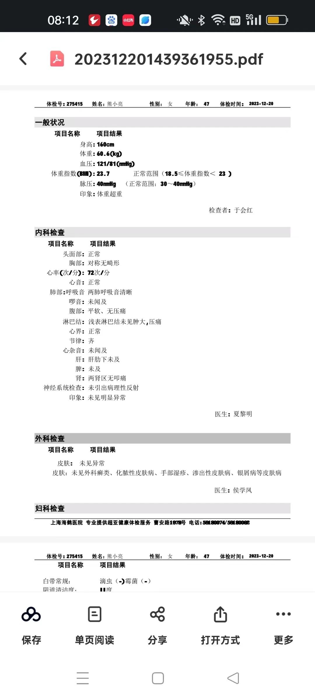 熊阿姨工作生活照9